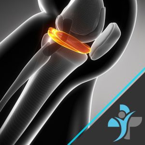 Understanding the meniscus